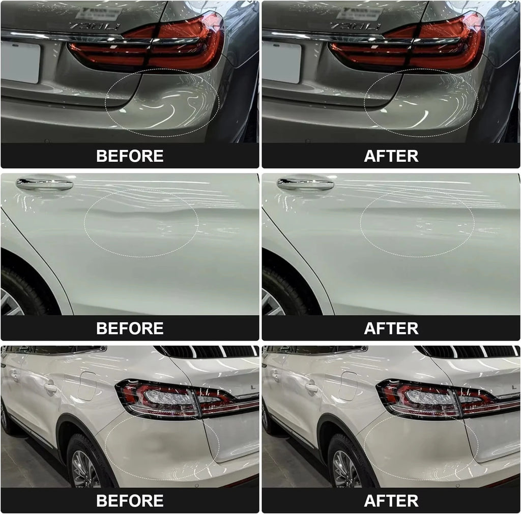 Hail Dent Removal Kit Dent Repair Tool Professional Paint-free Dent Repair Tool Suction Cup Dent Puller Tool Set